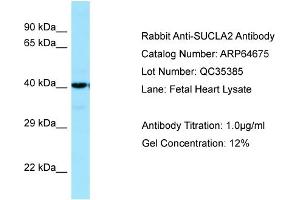 Western Blotting (WB) image for anti-Succinate-CoA Ligase, ADP-Forming, beta Subunit (SUCLA2) (C-Term) antibody (ABIN971821) (SUCLA2 Antikörper  (C-Term))