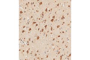 Immunohistochemistry (Paraffin-embedded Sections) (IHC (p)) image for anti-Signal Transducer and Activator of Transcription 1, 91kDa (STAT1) (AA 717-745), (C-Term) antibody (ABIN1881847)