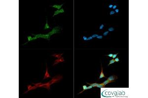 Image no. 3 for anti-Cytochrome P450, Family 19, Subfamily A, Polypeptide 1 (CYP19A1) (C-Term) antibody (ABIN363492)