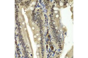 Immunohistochemistry of paraffin-embedded rat Intestine using RBBP5 antibody at dilution of 1:100 (x40 lens). (RBBP5 Antikörper)