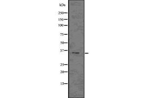 Western blot analysis NKp46 using COLO205 whole cell lysates (NCR1 Antikörper  (Internal Region))