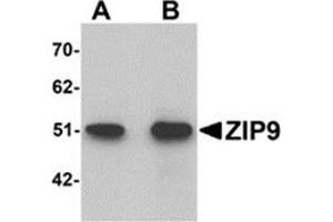 Western blot analysis of ZIP9 in HepG2 cell lysate with ZIP9 antibody at (A) 1 and (B) 2 μg/ml. (SLC39A9 Antikörper  (N-Term))
