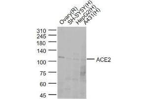 Lane 1: Rat Ovary lysates; Lane 2:SH-SY5Y cell lysates; Lane 3:HepG2 cell lysates; Lane 4: A431 cell lysates probed with ACE2 Polyclonal Antibody, Unconjugated (bs-23027R) at 1:1000 dilution and 4˚C overnight incubation. (ACE2 Antikörper  (AA 251-350))