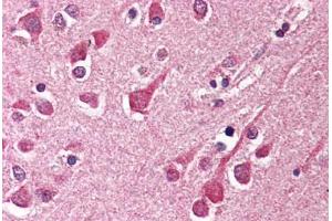 Human Brain, Cortex (formalin-fixed, paraffin-embedded) stained with KIAA1303 antibody ABIN214505 at 2. (Raptor Antikörper)