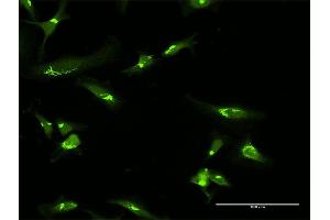 Immunofluorescence (IF) image for anti-Golgin A2 (GOLGA2) (AA 1-990) antibody (ABIN947930)