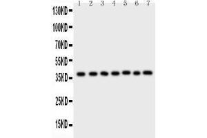 Western Blotting (WB) image for anti-Aryl Hydrocarbon Receptor Interacting Protein (AIP) (AA 91-330) antibody (ABIN3043728)