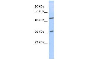 LIX1 antibody used at 1 ug/ml to detect target protein.