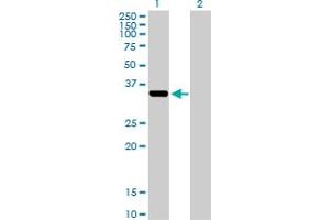 Western Blot analysis of AKR1C2 expression in transfected 293T cell line by AKR1C2 MaxPab polyclonal antibody. (AKR1C2 Antikörper  (AA 1-323))