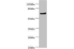 Western blot All lanes: CDC16 antibody at 4 μg/mL + Jurkat whole cell lysate Secondary Goat polyclonal to rabbit IgG at 1/10000 dilution Predicted band size: 72, 66, 61 kDa Observed band size: 72 kDa (CDC16 Antikörper  (AA 371-620))