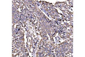IHC analysis of Calnexin/CANX using anti-Calnexin/CANX antibody (ABIN7602290).