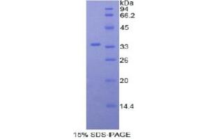 SDS-PAGE analysis of Mouse Myosin ID Protein. (Myosin ID Protein (MYO1D))
