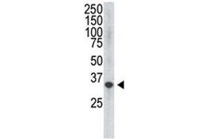 The VEGF4 antibody used in western blot to detect VEGF4 in HDMEC cell lysate (VEGFD Antikörper  (C-Term, N-Term))