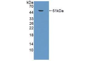 Western blot analysis of recombinant Mouse SPC. (Surfactant Protein C Antikörper  (AA 1-193))
