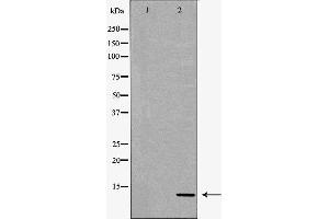 Western blot analysis of extracts of HeLa , using S100A4antibody. (s100a4 Antikörper  (C-Term))