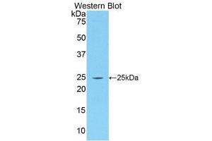 Western Blotting (WB) image for anti-Procollagen III N-Terminal Propeptide (PIIINP) (AA 24-153) antibody (ABIN1173222) (PIIINP Antikörper  (AA 24-153))