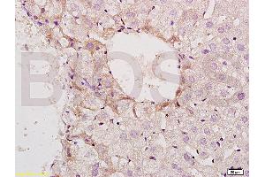 Formalin-fixed and paraffin embedded mouse small intestine tissue labeled with Anti-Phospho-GCN2 (Thr898) Polyclonal Antibody, Unconjugated (ABIN684943) at 1:200 followed by conjugation to the secondary antibody and DAB staining (GCN2 Antikörper  (pThr899))