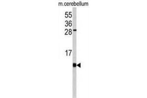 Western Blotting (WB) image for anti-FK506 Binding Protein 1B, 12.6 KDa (FKBP1B) antibody (ABIN3003541)