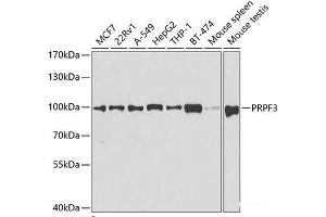 Western blot analysis of extracts of various cell lines using PRPF3 Polyclonal Antibody at dilution of 1:1000.