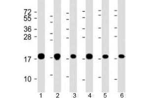 Western blot testing of human 1) A549, 2) HeLa, 3) HepG2, 4) U-2OS, 5) Jurkat and 6) placenta lysate with COMMD1 antibody at 1:2000.
