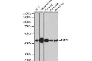 Western blot analysis of extracts of various cell lines, using RS antibody (ABIN7269832) at 1:1000 dilution.