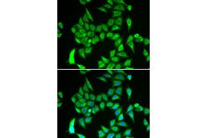 Immunofluorescence analysis of A549 cells using IREB2 antibody. (IREB2 Antikörper)