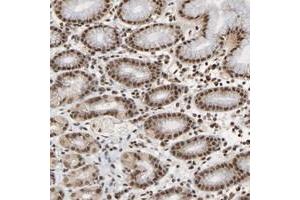 Immunohistochemical staining of human stomach with ZNF384 polyclonal antibody  shows strong nuclear positivity in glandular cells at 1:50-1:200 dilution. (ZNF384 Antikörper)