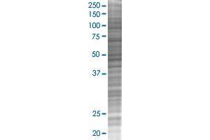 STAU2 transfected lysate. (STAU2 293T Cell Transient Overexpression Lysate(Denatured))