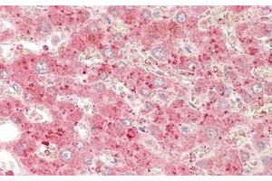 Immunohistochemistry (IHC) image for anti-Cytochrome P450, Family 1, Subfamily A, Polypeptide 1 (CYP1A1) (AA 1-250) antibody (ABIN7435463)