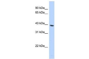 SPON2 antibody used at 1 ug/ml to detect target protein. (SPON2 Antikörper  (N-Term))
