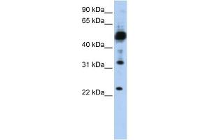 TMEM38B antibody used at 1 ug/ml to detect target protein. (TMEM38B Antikörper  (C-Term))