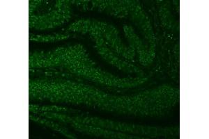 IF analysis of SNRNP27 using anti-SNRNP27 antibody (ABIN7599614). (SNRNP27 Antikörper  (AA 100-155))