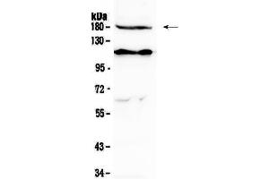 Western blot analysis of VEGF Receptor 2  using anti-VEGF Receptor 2  antibody . (VEGFR2/CD309 Antikörper  (AA 20-242))