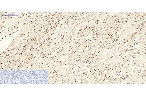 Immunohistochemistry of paraffin-embedded Human uterus tissue using CBX5 Monoclonal Antibody at dilution of 1:200. (CBX5 Antikörper)