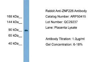WB Suggested Anti-ZNF226  Antibody Titration: 0. (ZNF226 Antikörper  (Middle Region))