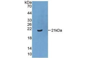 Detection of Recombinant XPo1, Human using Polyclonal Antibody to Exportin 1 (XPO1) (XPO1 Antikörper  (AA 917-1071))
