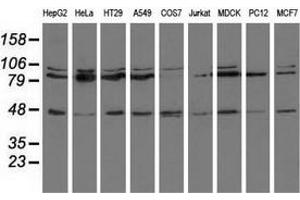 Western blot analysis of extracts (35 µg) from 9 different cell lines by using anti-CD80 monoclonal antibody. (CD80 Antikörper)