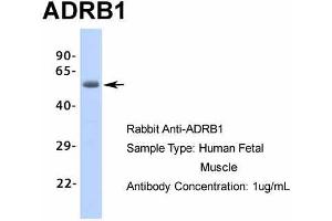 Host: Rabbit Target Name: ADRB1 Sample Type: Human Fetal Muscle Antibody Dilution: 1.