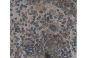 IHC-P analysis of Mouse Tissue, with DAB staining. (TRADD Antikörper  (AA 21-259))