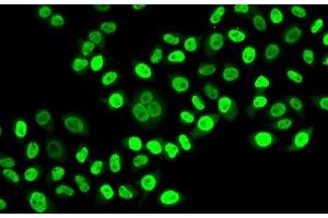 Immunofluorescence analysis of HeLa cells using NUDC Polyclonal Antibody