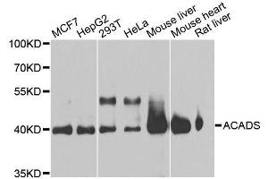 Western blot analysis of extracts of various cell lines, using ACADS antibody. (ACADS Antikörper  (AA 1-260))