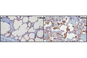 Typical pulmonal findings in SP-A (surfactant protein A) immunohistochemistry. (Surfactant Protein A1 Antikörper  (Internal Region))