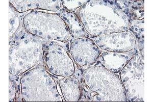 Immunohistochemical staining of paraffin-embedded Human Kidney tissue using anti-LDLRAP1 mouse monoclonal antibody. (LDLRAP1 Antikörper)