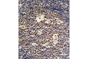 IL-4 antibody IHC analysis in formalin fixed and paraffin embedded tonsil