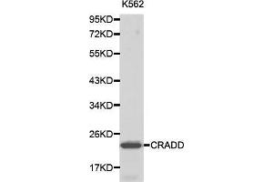 Western blot analysis of K562 cell lysate using CRADD antibody. (CRADD Antikörper  (AA 1-199))