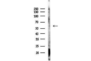 anti-Lipase, Hepatic (LIPC) (Internal Region) antibody
