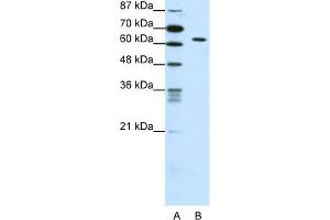 WB Suggested Anti-SMAD1 Antibody Titration:  0. (SMAD1 Antikörper  (C-Term))