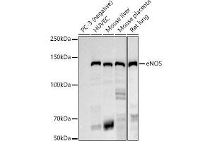 Western blot analysis of extracts of various cell lines, using eNOS antibody (ABIN7268920) at 1:1000 dilution.