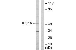 Western blot analysis of extracts from HUVEC cells, using IP3KA antibody. (ITPKA Antikörper  (C-Term))