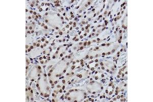 Immunohistochemistry of paraffin-embedded rat kidney using Acetyl-Histone H3-K27 Rabbit mAb (ABIN3016650, ABIN3016651, ABIN3016652, ABIN1682513 and ABIN1682514) at dilution of 1:100 (40x lens). (Histone 3 Antikörper  (acLys27))