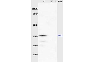 Lane 1: mouse brain lysates Lane 2: mouse kidney lysates probed with Anti RASSF2 Polyclonal Antibody, Unconjugated (ABIN681988) at 1:200 in 4 °C. (RASSF2 Antikörper  (AA 201-300))